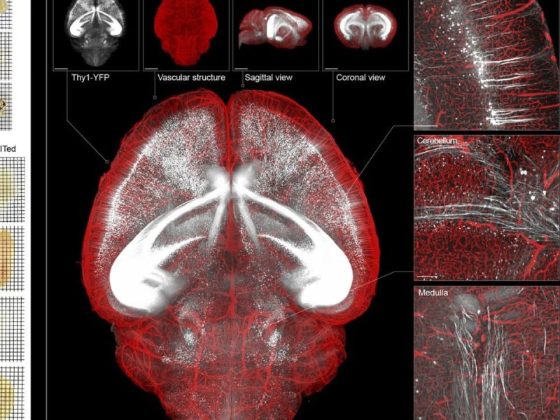 Новата китайска прозрачна техника на мозъка предлага най-ясен поглед върху вътрешната му работа