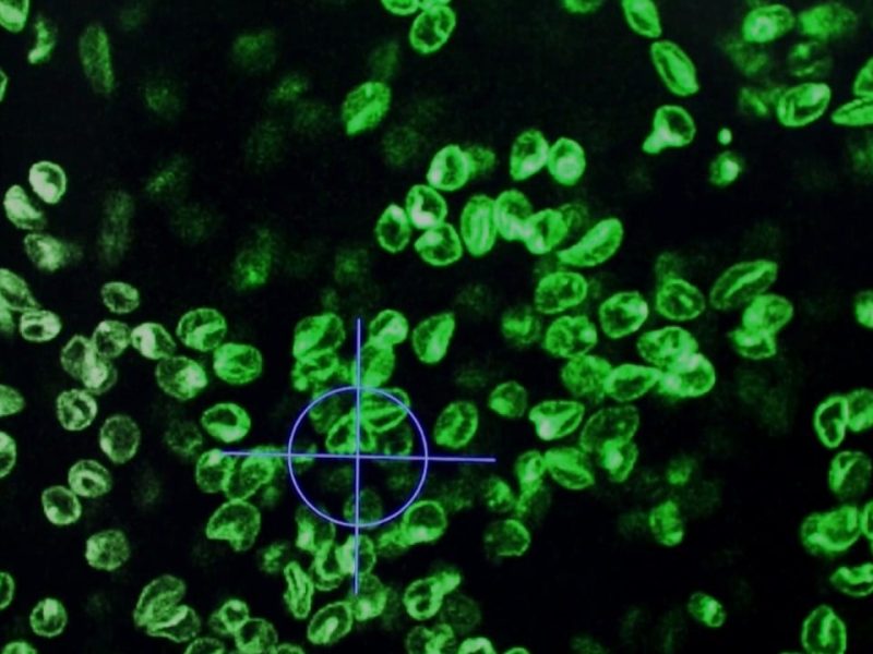 Учените от Обединеното кралство забавят болестта на Хънтингтън за първи път